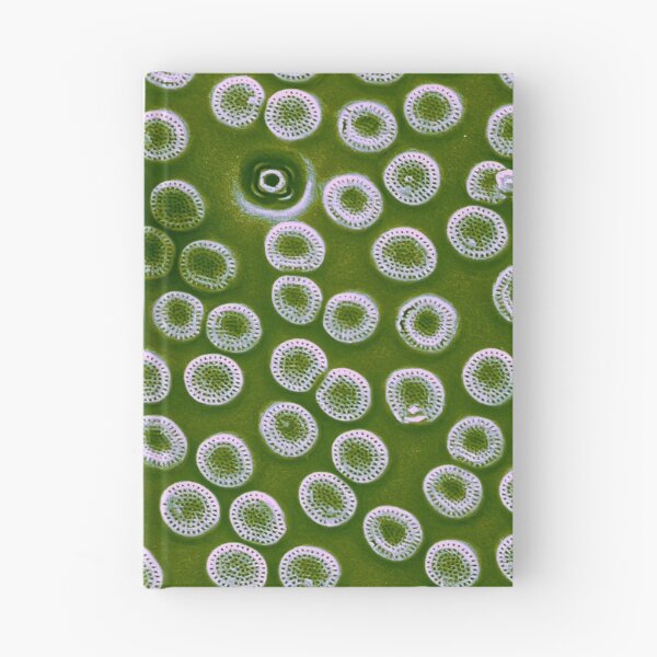 Item preview, Diatom - Cyclostephanos from Lake Malawi (pea green) designed and sold by DiatomsATTACK.