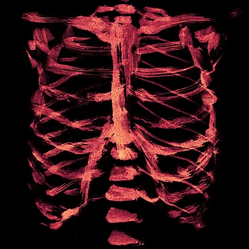 Artwork thumbnail, Red Ribcage by Teoft