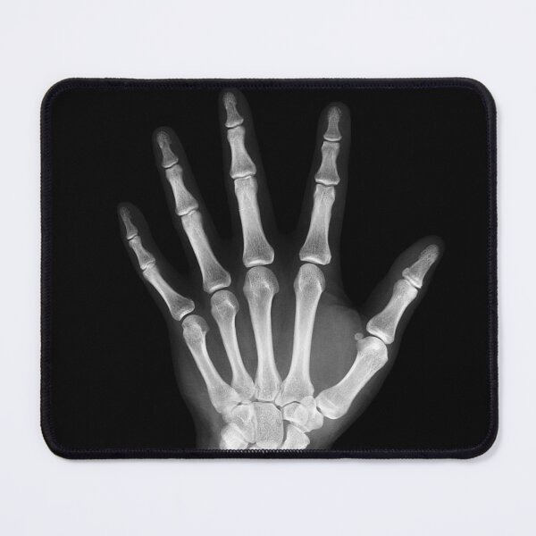 Item preview, You are Mine - I am Touching you - Human Hand Skeleton designed and sold by KeshaEls.