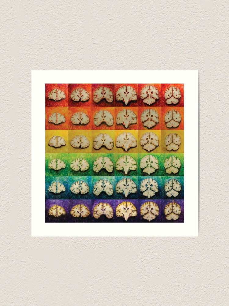 The Brain Bow Art Print By Msraz Redbubble