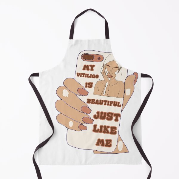 Item preview, MY VITILIGO IS BEAUTIFUL  JUST LIKE ME PHONE  designed and sold by DiscoVibes.