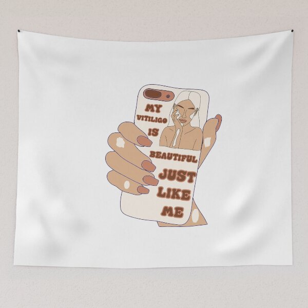 Item preview, MY VITILIGO IS BEAUTIFUL  JUST LIKE ME PHONE  designed and sold by DiscoVibes.