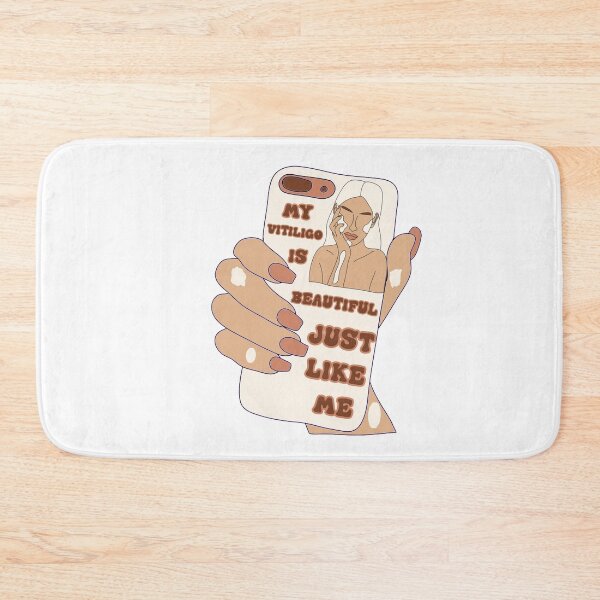 Item preview, MY VITILIGO IS BEAUTIFUL  JUST LIKE ME PHONE  designed and sold by DiscoVibes.