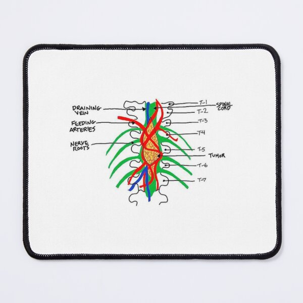 Item preview, Tumour On The Wall designed and sold by brookiecookie37.