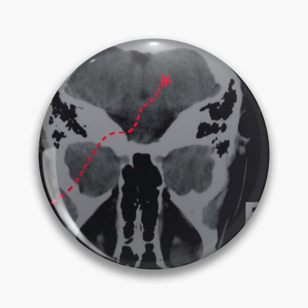 Item preview, Way to normal designed and sold by RonaldFiore.