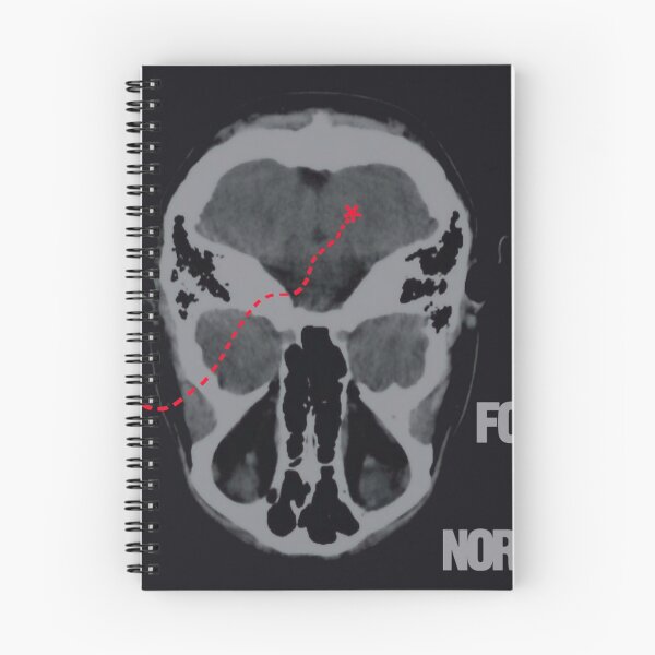 Item preview, Way to normal designed and sold by RonaldFiore.