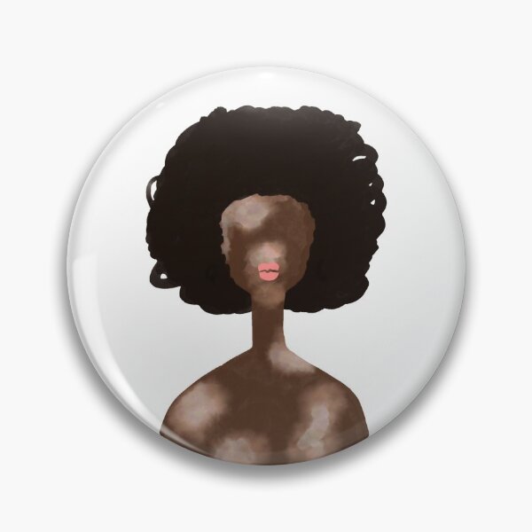 Item preview, Vitiligo woman portrait designed and sold by SolArt88.