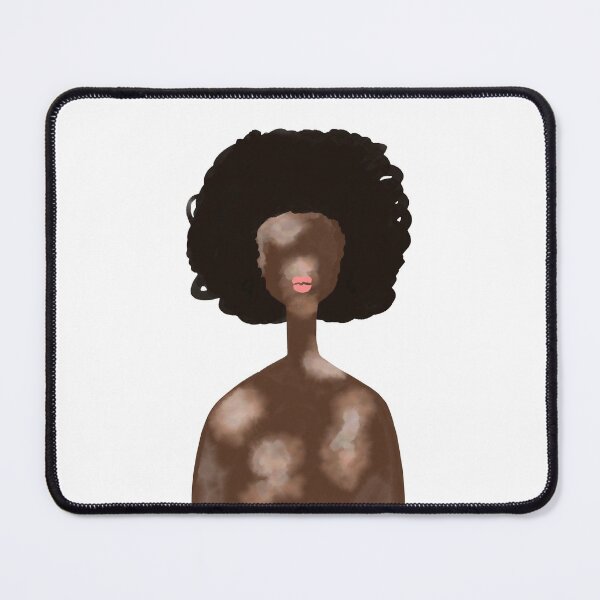 Item preview, Vitiligo woman portrait designed and sold by SolArt88.