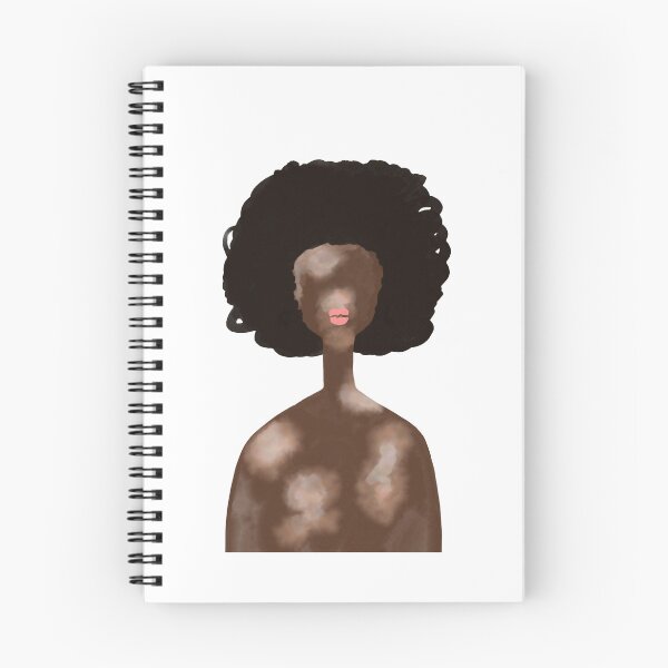 Item preview, Vitiligo woman portrait designed and sold by SolArt88.