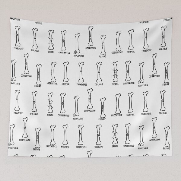 Item preview, Hand Drawn Types of Fractures In Black designed and sold by SofiaSava01.