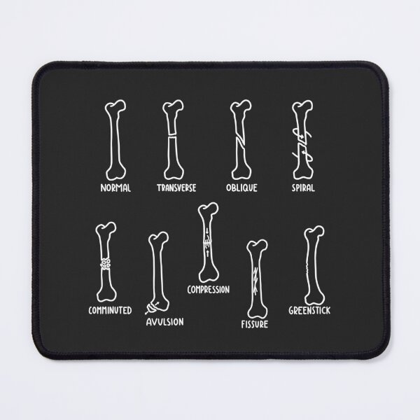Item preview, Hand Drawn Types of Fractures In White designed and sold by SofiaSava01.