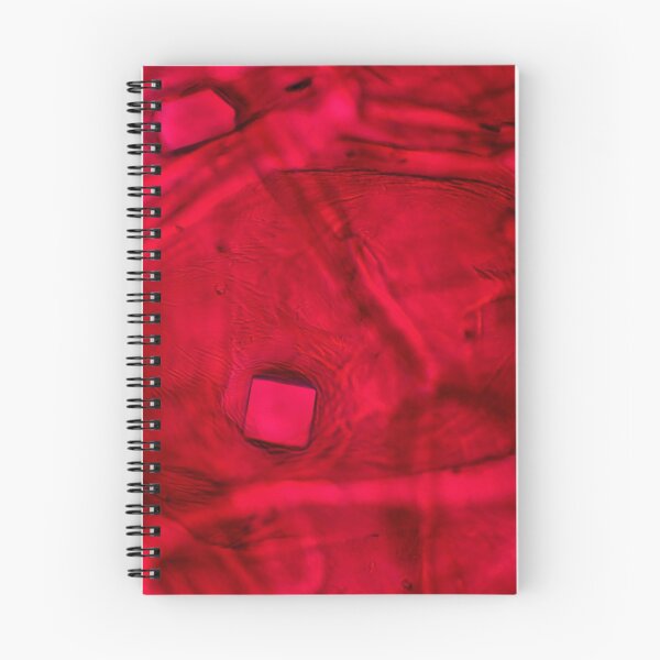 Item preview, Red onion skin with oxalate crystals under the microscope designed and sold by SDym Photography.