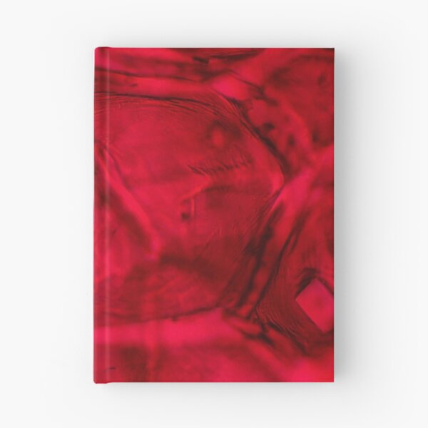 Item preview, Red onion skin with oxalate crystals under the microscope designed and sold by SDym Photography.