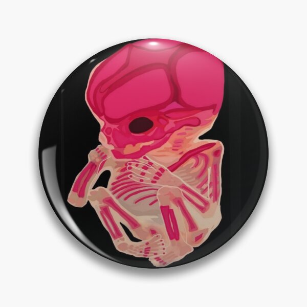 Item preview, Diaphonized Human Fetus designed and sold by Bea-Misanthrope.
