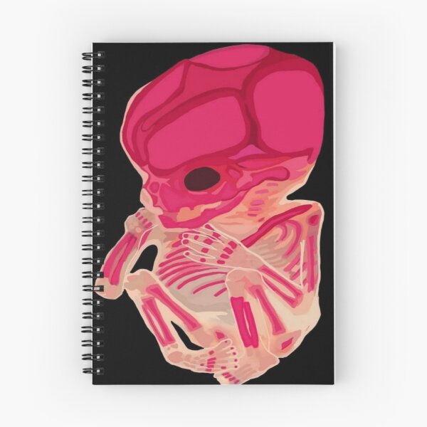 Item preview, Diaphonized Human Fetus designed and sold by Bea-Misanthrope.