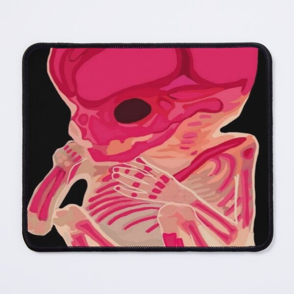 Item preview, Diaphonized Human Fetus designed and sold by Bea-Misanthrope.