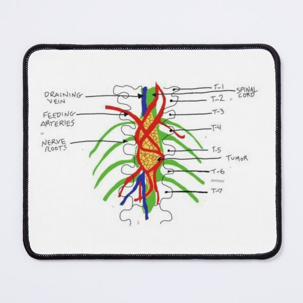Item preview, Greys- tumour on the wall designed and sold by Brodie Smith.