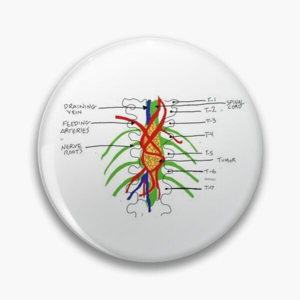 Item preview, Greys- tumour on the wall designed and sold by Brodie Smith.