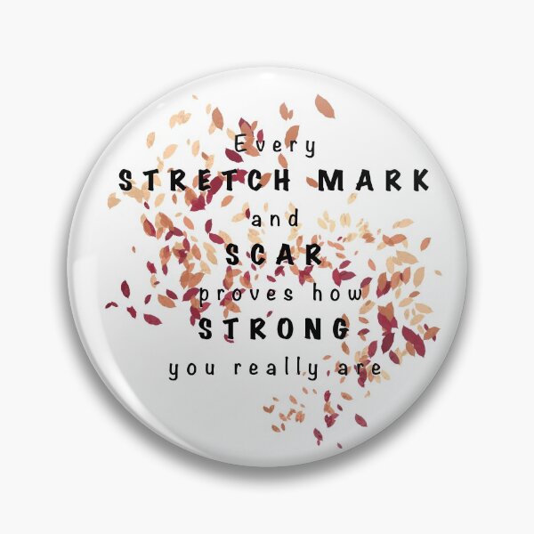 Item preview, Stretch Marks and Scars designed and sold by lkthayerart.
