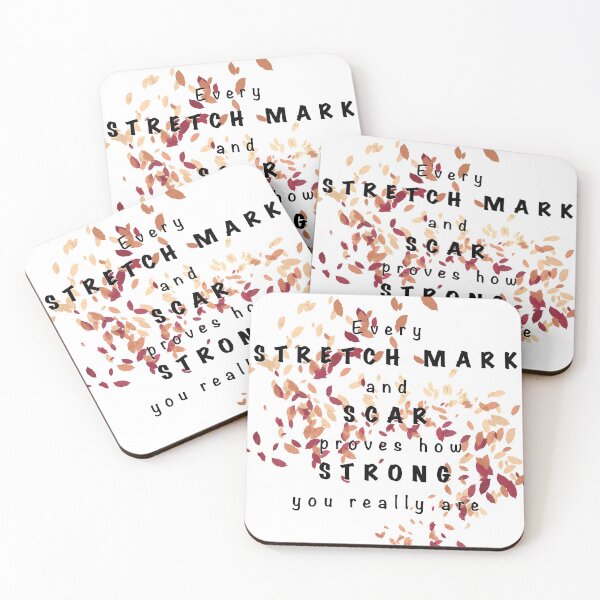 Item preview, Stretch Marks and Scars designed and sold by lkthayerart.