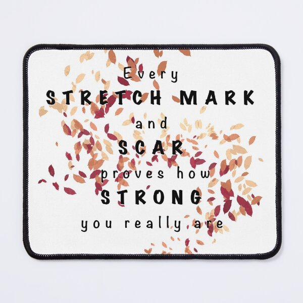 Item preview, Stretch Marks and Scars designed and sold by lkthayerart.