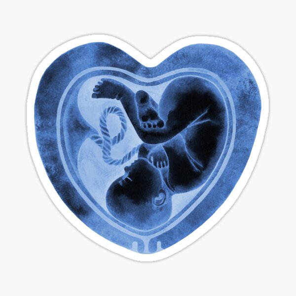 Item preview, Watercolor fetus inside the heart shaped womb designed and sold by Ekaterina Glazkova.