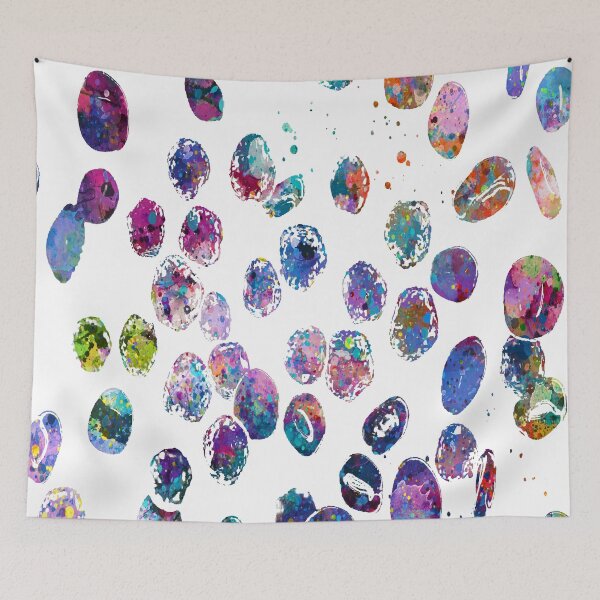Item preview, Bone Marrow Acute Lymphoblastic Leukemia  designed and sold by EvasDreams.