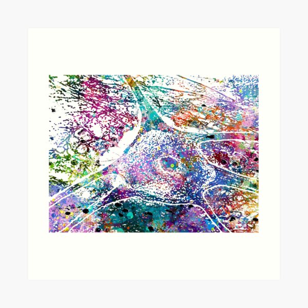 Impression artistique