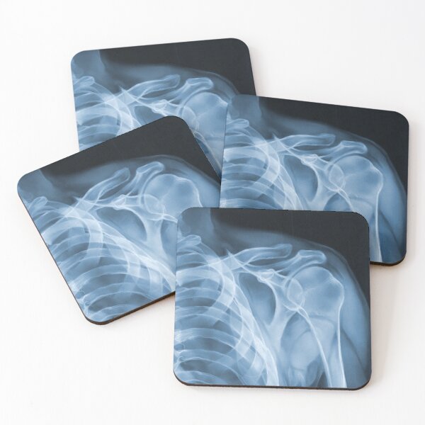 Item preview, X-Ray of Shoulder & Ribs designed and sold by whim-n-wonder.