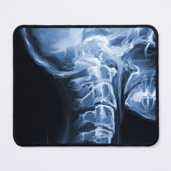 Item preview, X-Ray of Spine & Skull designed and sold by whim-n-wonder.