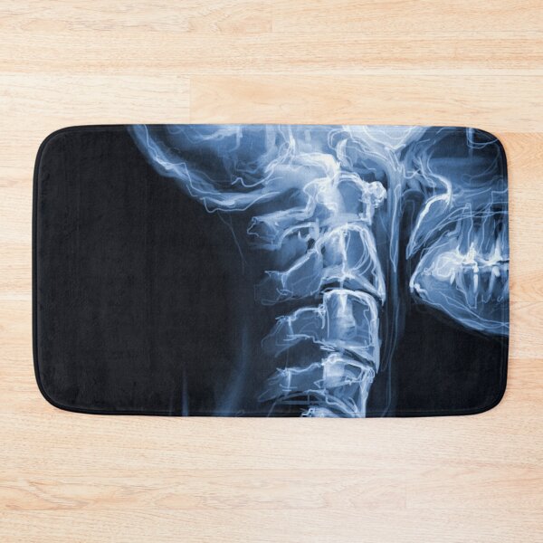 Item preview, X-Ray of Spine & Skull designed and sold by whim-n-wonder.