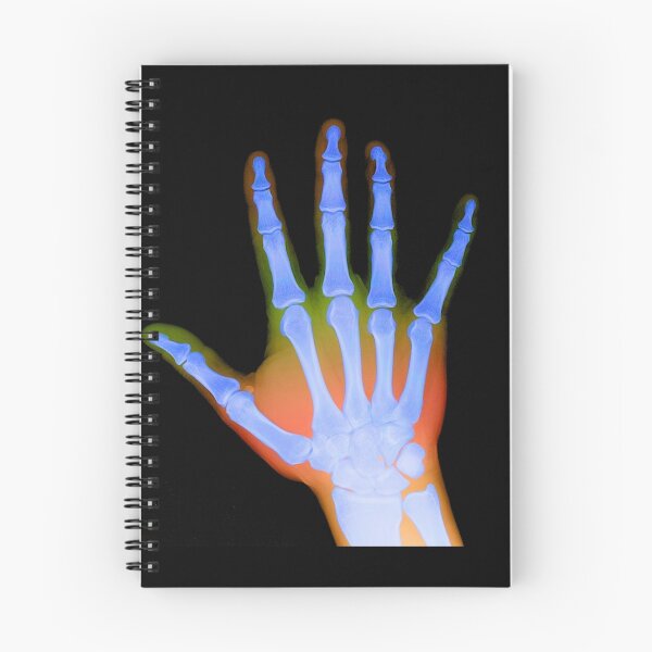 Item preview, X-Ray of a Hand designed and sold by ScienceSource.