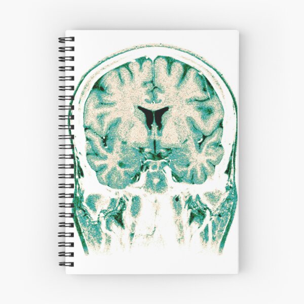 Item preview,  Normal Coronal MRI of the Brain  designed and sold by ScienceSource.