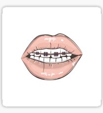 Lips braces Sticker