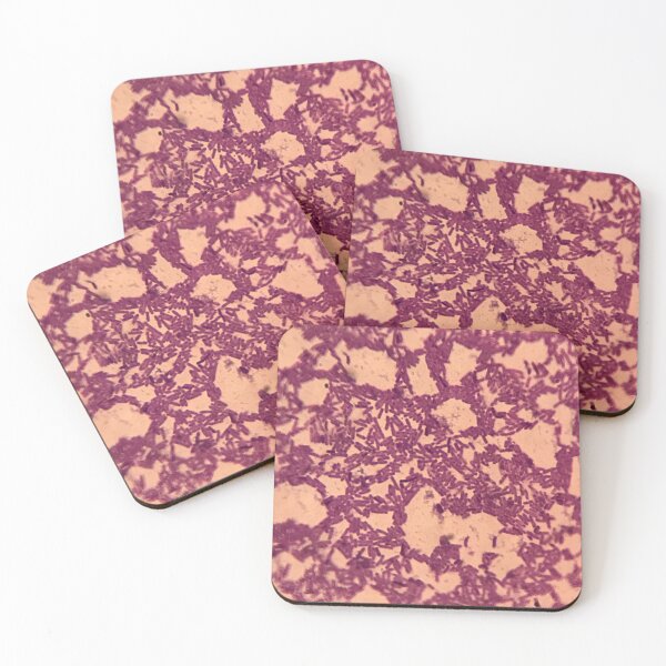 Item preview, Bacteria photograph  designed and sold by espefloresca.