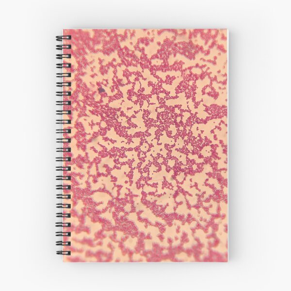 Item preview, Bacteria photograph  designed and sold by espefloresca.