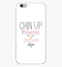 chin up princess iPhone Case
