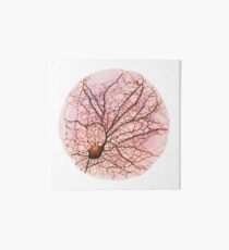 Dendritic tree and spines of an hippocampal neuron - watercolour - Pink Art Board Print