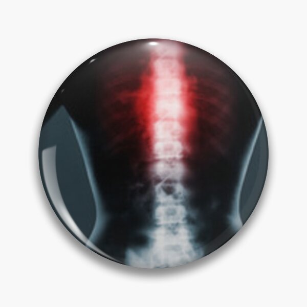 Item preview, 	Radiology chest spine designed and sold by Dbanksdesign.