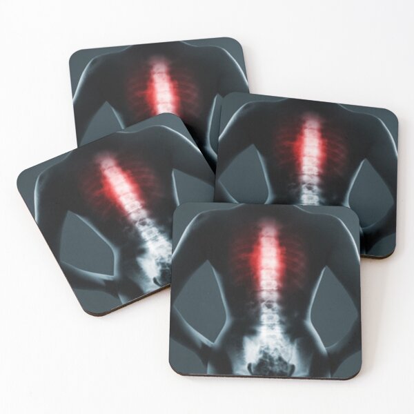 Item preview, 	Radiology chest spine designed and sold by Dbanksdesign.