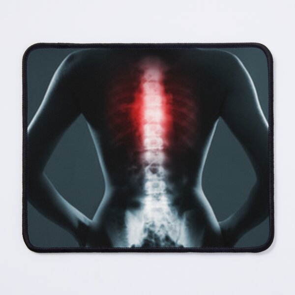 Item preview, 	Radiology chest spine designed and sold by Dbanksdesign.