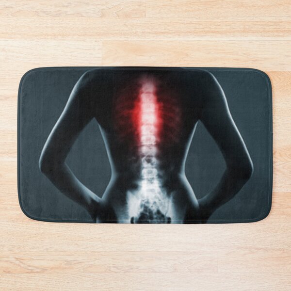 Item preview, 	Radiology chest spine designed and sold by Dbanksdesign.