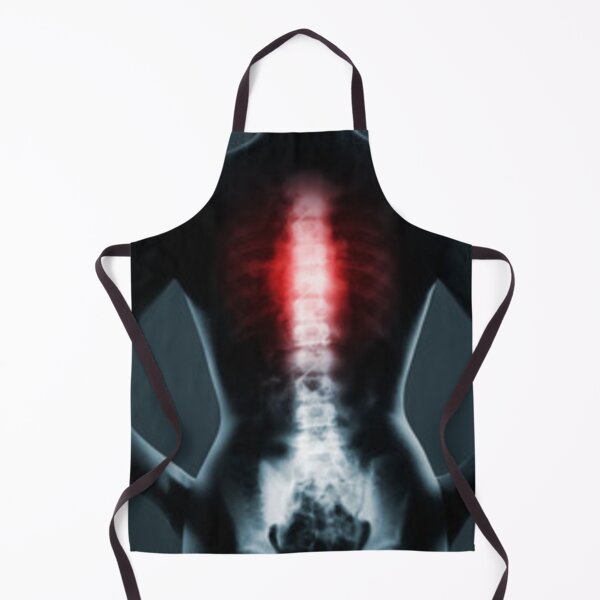 Item preview, 	Radiology chest spine designed and sold by Dbanksdesign.