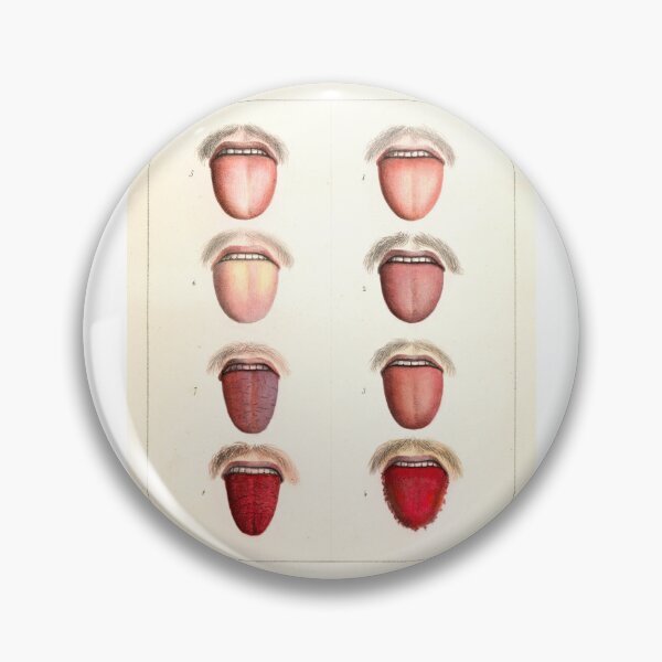 Item preview, Vintage Illustration of Tongues Affected by Yellow Fever designed and sold by TheMurphyGirl.