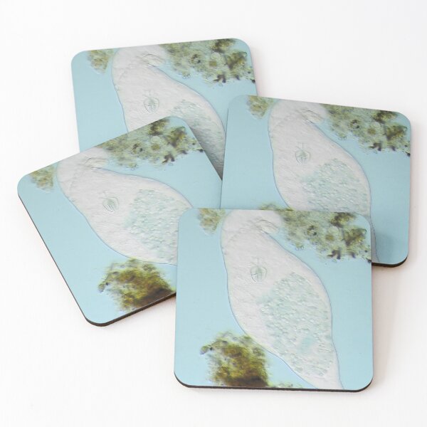 Item preview, Bdelloid rotifer under the microscope designed and sold by SDym Photography.