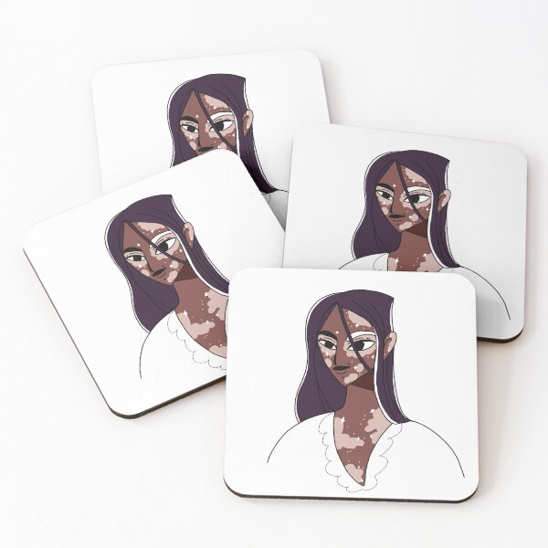 Item preview, African American woman with vitiligo. happiness designed and sold by LinaKarolina13.