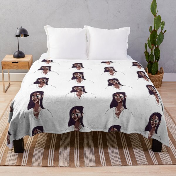 Item preview, African American woman with vitiligo. happiness designed and sold by LinaKarolina13.