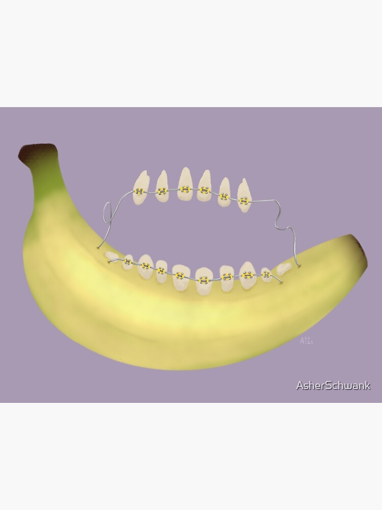 "Tooth Banana (With Braces!) " Poster by AsherSchwank Redbubble