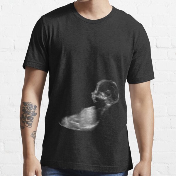 "Ultrasound" Tshirt for Sale by AnderMollosen Redbubble ultrasound
