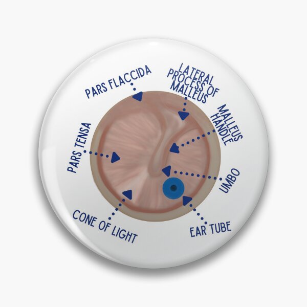 Item preview, Ear Drum with Ear Tube designed and sold by Hear4theEars.
